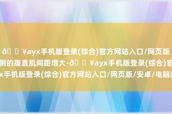 🔥ayx手机版登录(综合)官方网站入口/网页版/安卓/电脑版腹白线两侧的腹直肌间距增大-🔥ayx手机版登录(综合)官方网站入口/网页版/安卓/电脑版